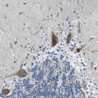 Anti-LIAS antibody produced in rabbit 