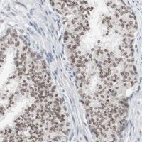 Anti-LIG3 antibody produced in rabbit 