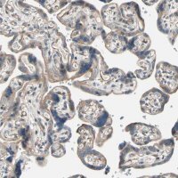 Anti-LIMK2 antibody produced in rabbit 