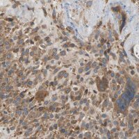 Anti-LIMK2 antibody produced in rabbit 