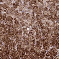 Anti-LIMS1 antibody produced in rabbit 