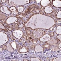 Anti-LIN7C antibody produced in rabbit 