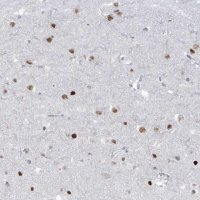 Anti-LIN9 antibody produced in rabbit 