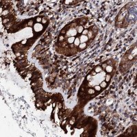 Anti-LIPT2 antibody produced in rabbit 