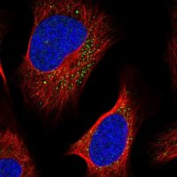 Anti-LIPT2 antibody produced in rabbit 