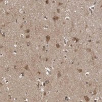 Anti-LLGL1 antibody produced in rabbit 