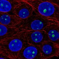 Anti-LLPH antibody produced in rabbit HPA058786-100UL