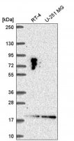Anti-LLPH antibody produced in rabbit HPA058786-100UL