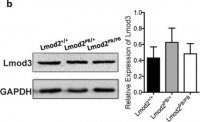 Anti-LMOD3 antibody produced in rabbit 