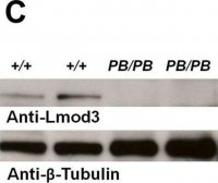 Anti-LMOD3 antibody produced in rabbit 