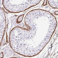 Anti-LOXL4 antibody produced in rabbit 
