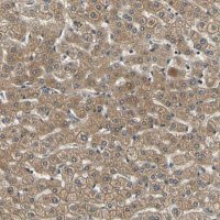 Anti-LPGAT1 antibody produced in rabbit 
