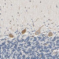 Anti-LPGAT1 antibody produced in rabbit 