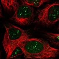 Anti-LPIN1 antibody produced in rabbit 