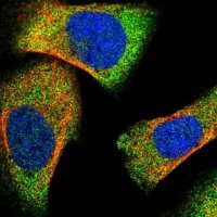 Anti-LPIN2 antibody produced in rabbit