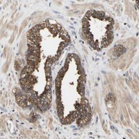 Anti-LRBA antibody produced in rabbit 