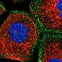Anti-LRCH1 antibody produced in rabbit 