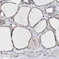 Anti-LRIG3 antibody produced in rabbit 