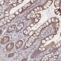 Anti-LRP5 antibody produced in rabbit 