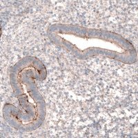 Anti-LRRC15 antibody produced in rabbit 