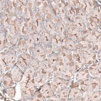Anti-LRRC15 antibody produced in rabbit 