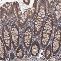 Anti-LRRC2 antibody produced in rabbit