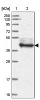 Anti-LRRC2 antibody produced in rabbit