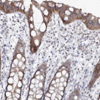 Anti-LRRC31 antibody produced in rabbit HPA037548-100UL