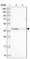 Anti-LRRC31 antibody produced in rabbit HPA037548-100UL