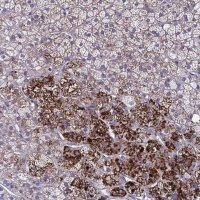Anti-LRRC38 antibody produced in rabbit