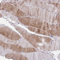 Anti-LRRC38 antibody produced in rabbit