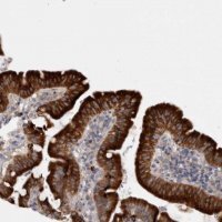 Anti-LRRC40 antibody produced in rabbit 