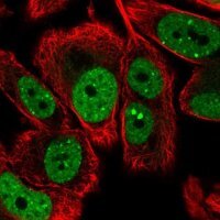 Anti-LRRC41 antibody produced in rabbit
