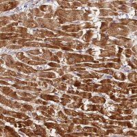 Anti-LRRC69 antibody produced in rabbit 
