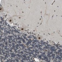 Anti-LRRC8B antibody produced in rabbit 