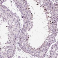 Anti-LRRIQ3 antibody produced in rabbit HPA030799-100UL