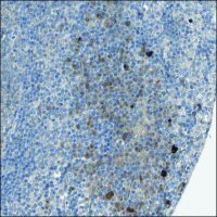 Anti-LRRK1 antibody produced in rabbit HPA010537-100UL