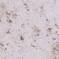 Anti-LRRN3 antibody produced in rabbit 