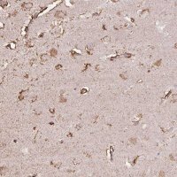 Anti-LRTM2 antibody produced in rabbit HPA055094-100UL