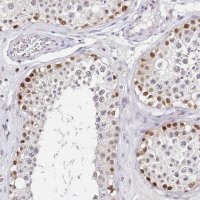 Anti-LSM3 antibody produced in rabbit