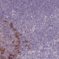Anti-LTB antibody produced in rabbit 