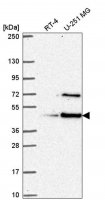 Anti-LUC7L antibody produced in rabbit HPA056424-100UL