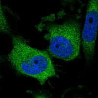 Anti-LYPLAL1 antibody produced in rabbit 
