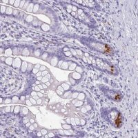 Anti-LYRM2 antibody produced in rabbit