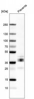Anti-LYVE1 antibody produced in rabbit