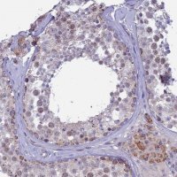 Anti-M1AP antibody produced in rabbit 