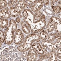 Anti-MACC1 antibody produced in rabbit 
