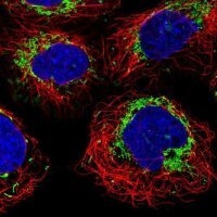 Anti-MACC1 antibody produced in rabbit 