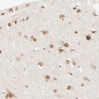 Anti-MAD1L1 antibody produced in rabbit