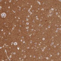 Anti-MADD antibody produced in rabbit